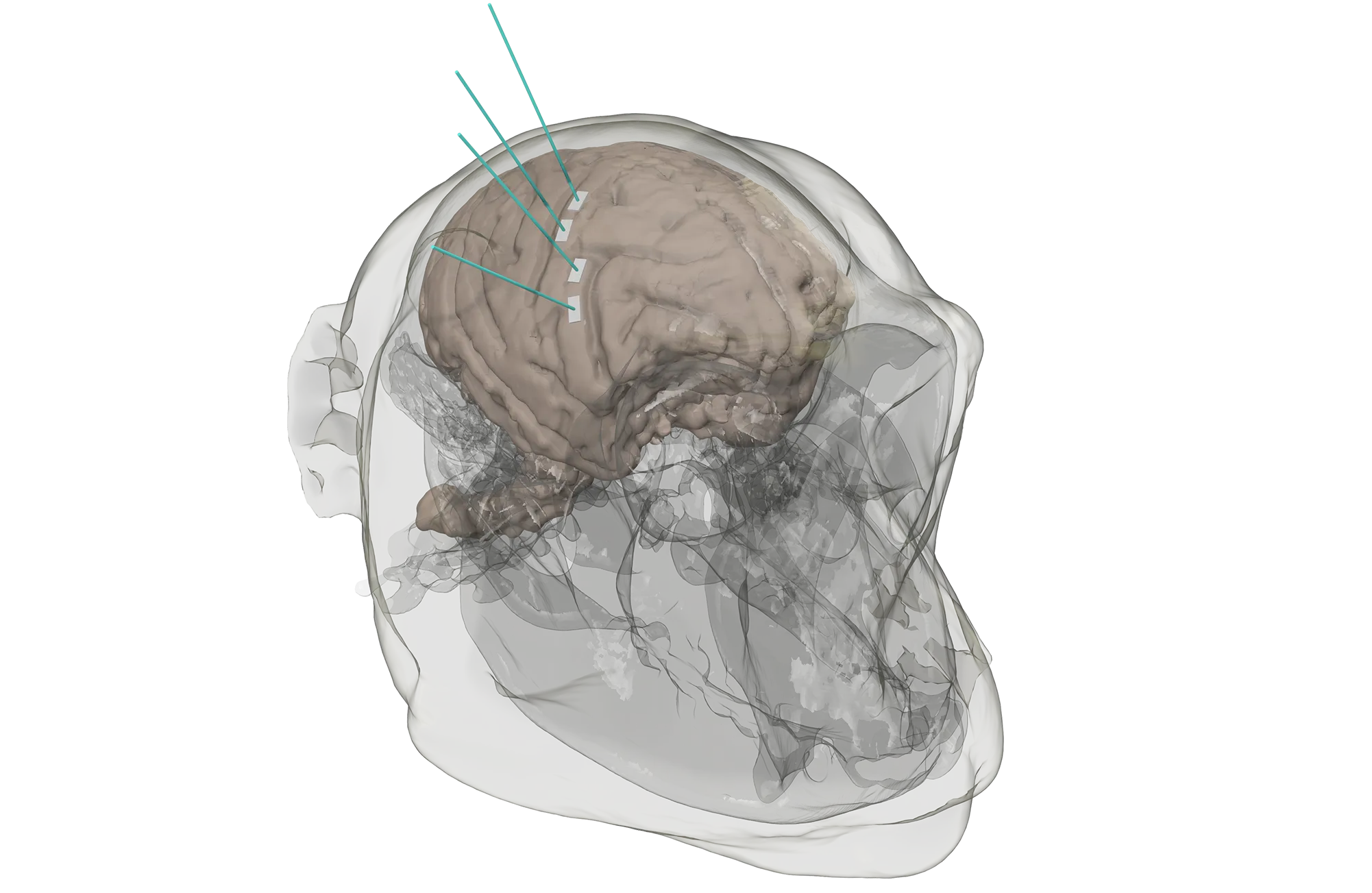 Plan your surgery in depth