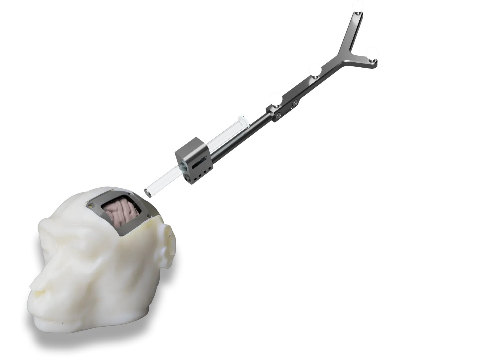 Simulate prior to surgery